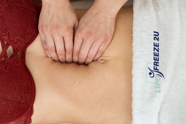 diastasis recti treatment Hampshire