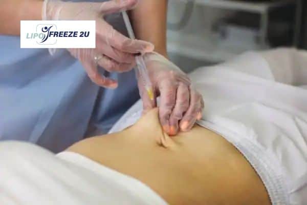 Fat Dissolving Injections Hampshire & Weight loss medication
