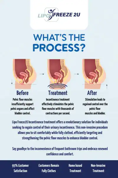 Diagram of how incontinence treatment Hampshire works.