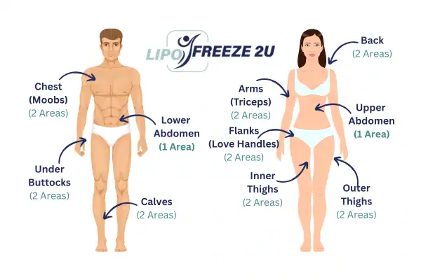 Areas you can have fat freezing treatment Hampshire