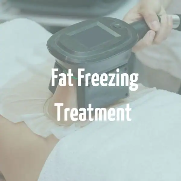 fat freezing treatment Hampshire