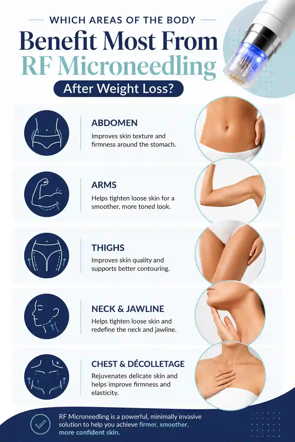 Which Areas of the Body Benefit Most From RF Microneedling After Weight Loss Hampshire